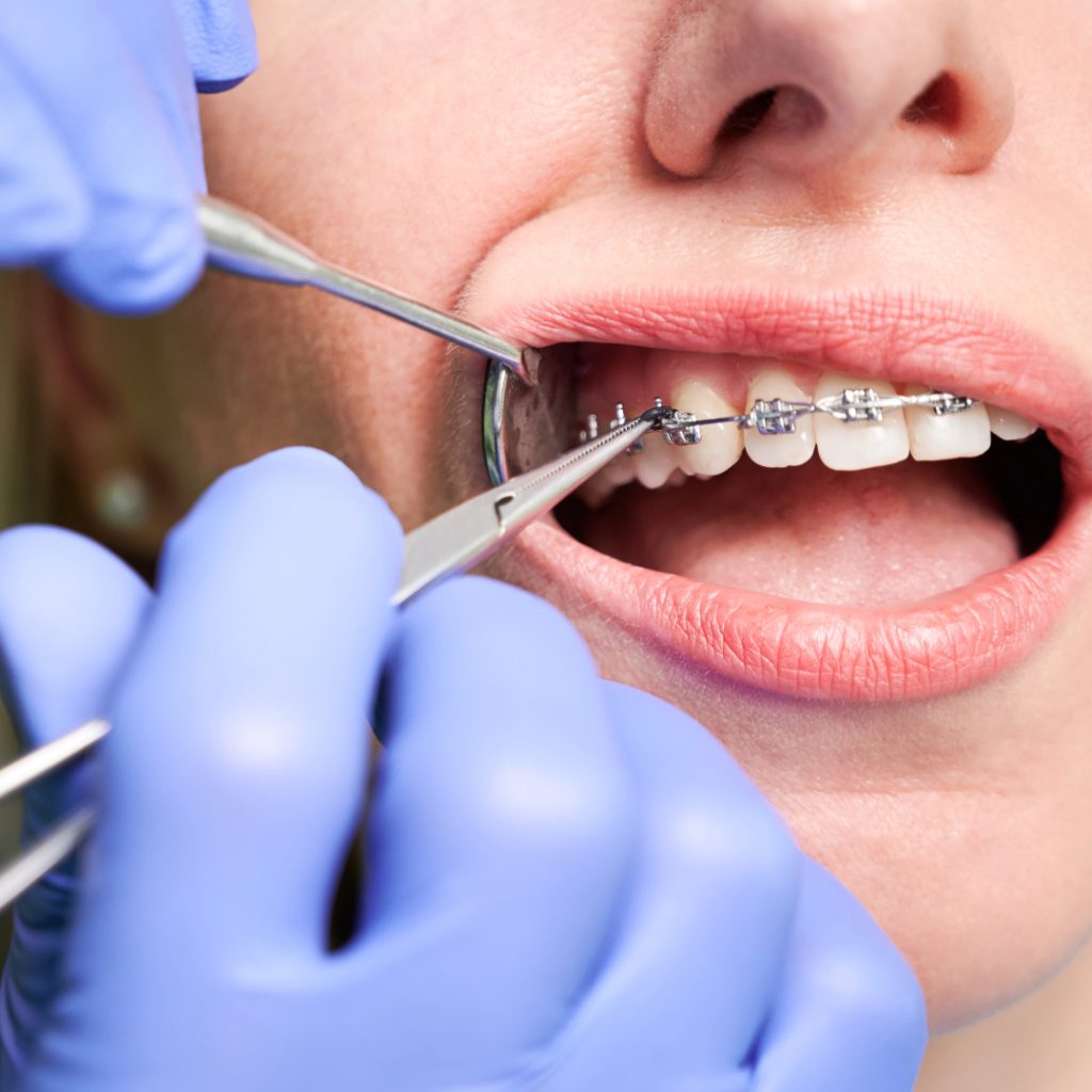 Orthodontics