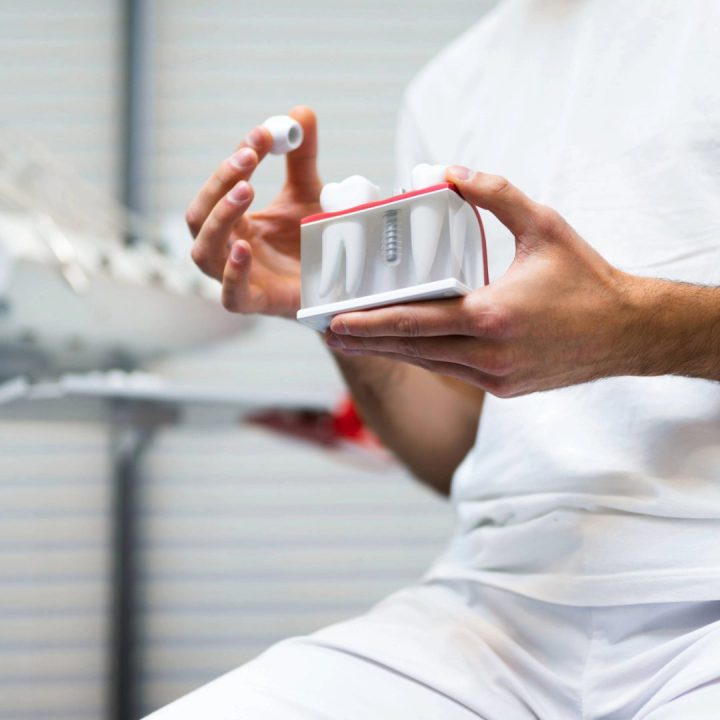Dental Implants