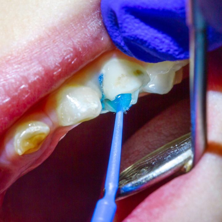 Endodontics